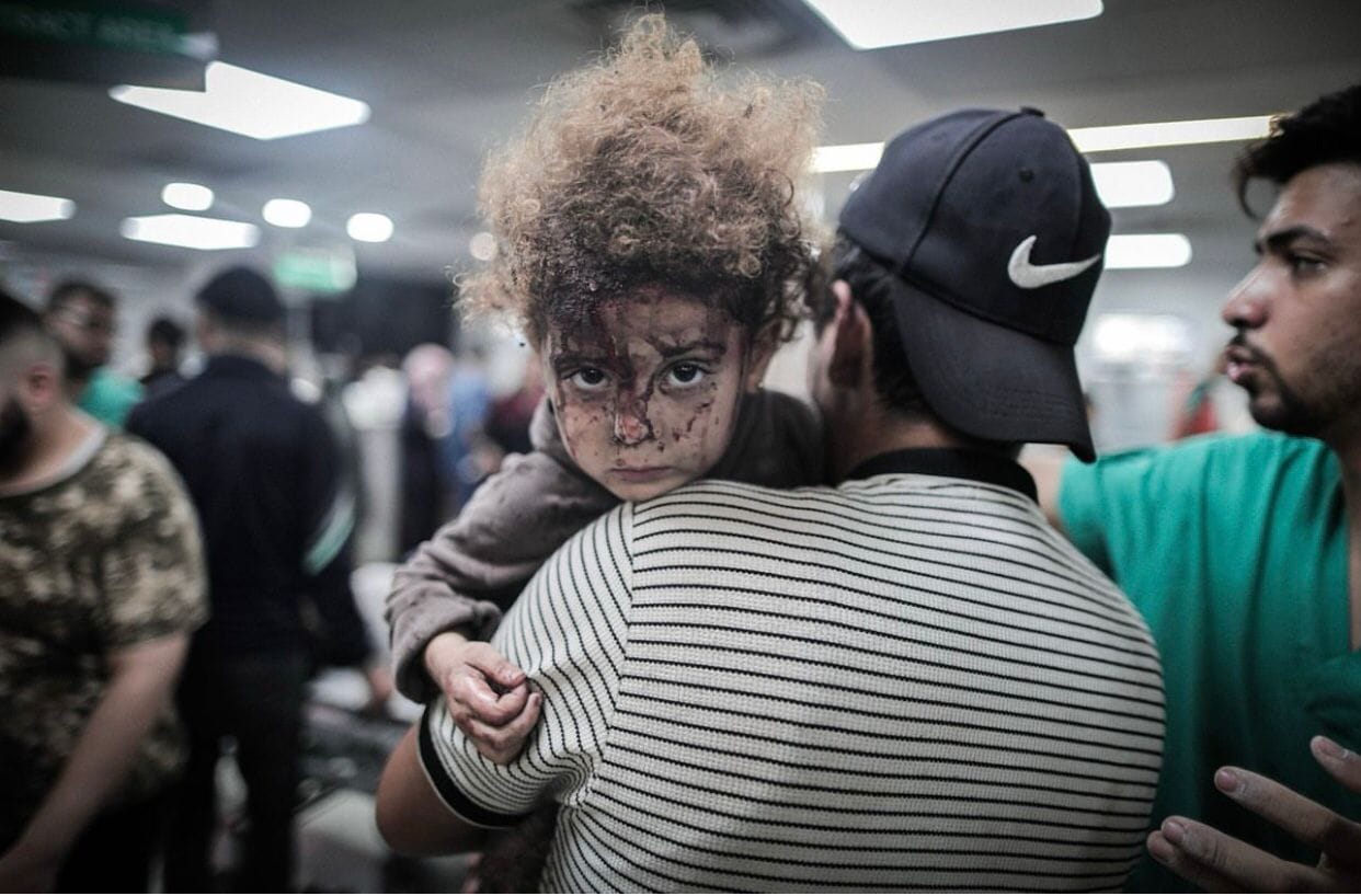 A young girl looks over her father's shoulder. He is carrying her. She has blood all over her face and is staring directly at the camera. 